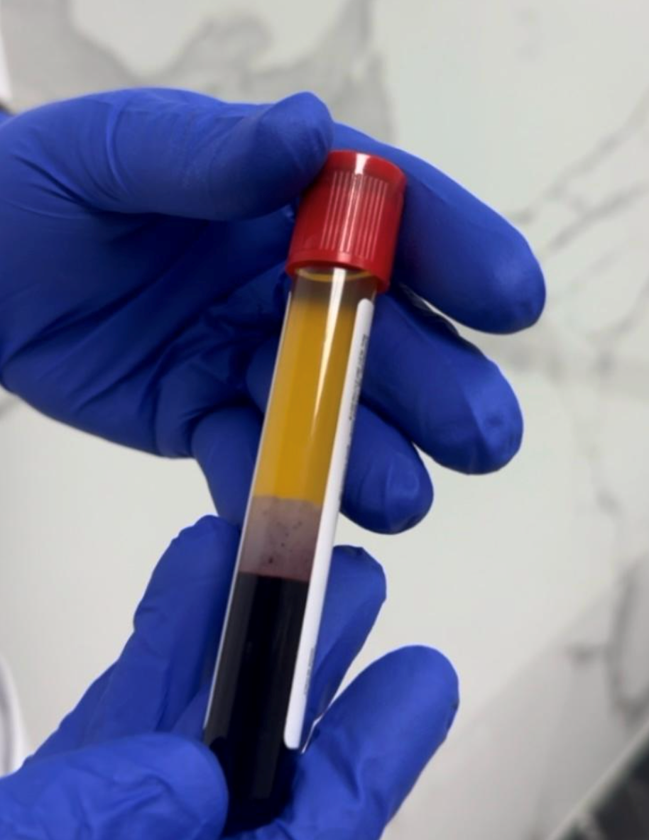 botox-den-haag dreamclinics