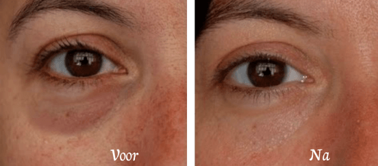 traangootjes dreamclinics